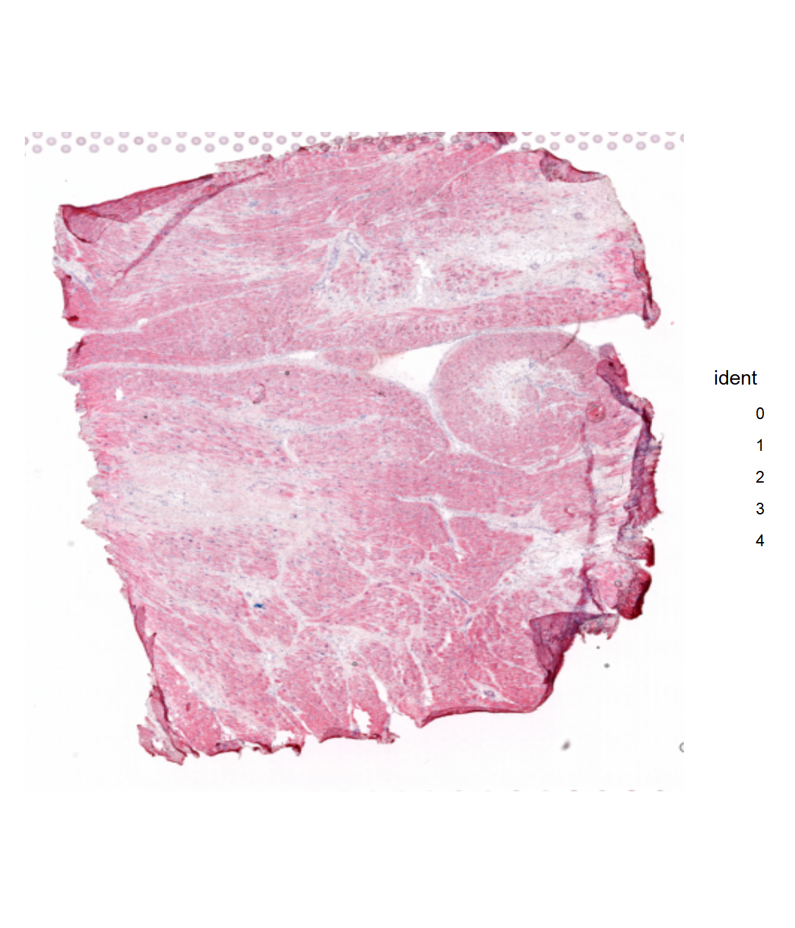 Structural analysis with MISTy - based on DOT deconvolution